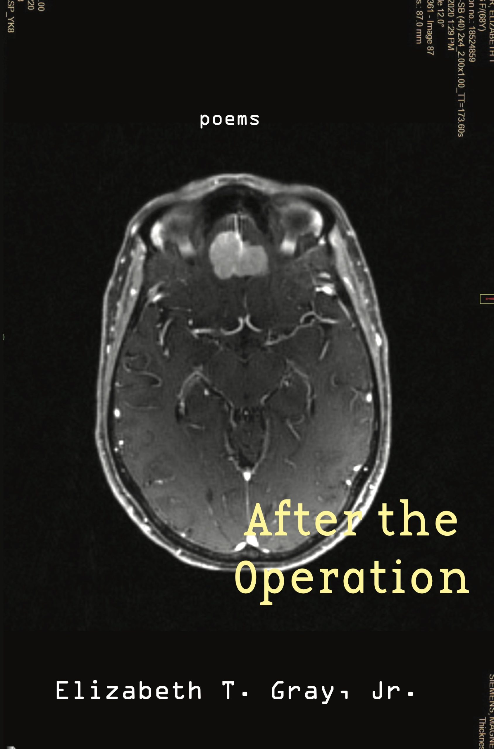Book Cover: After the Operation